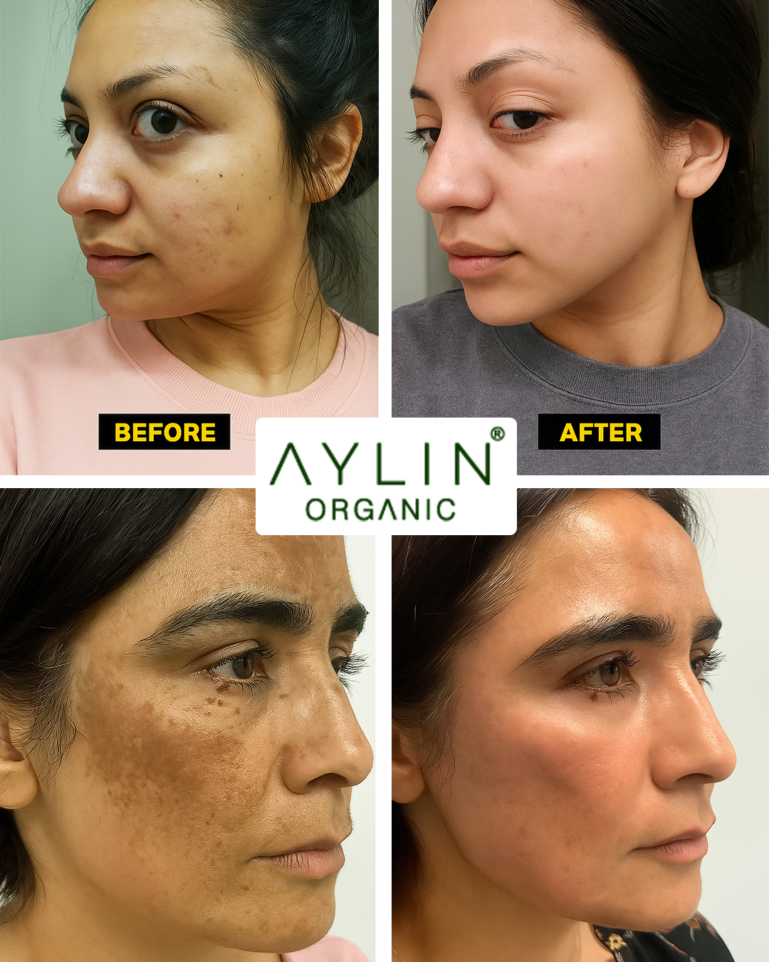 Aylin Organic Full Body Brightening Cream with Pineapple Extract - 100mle